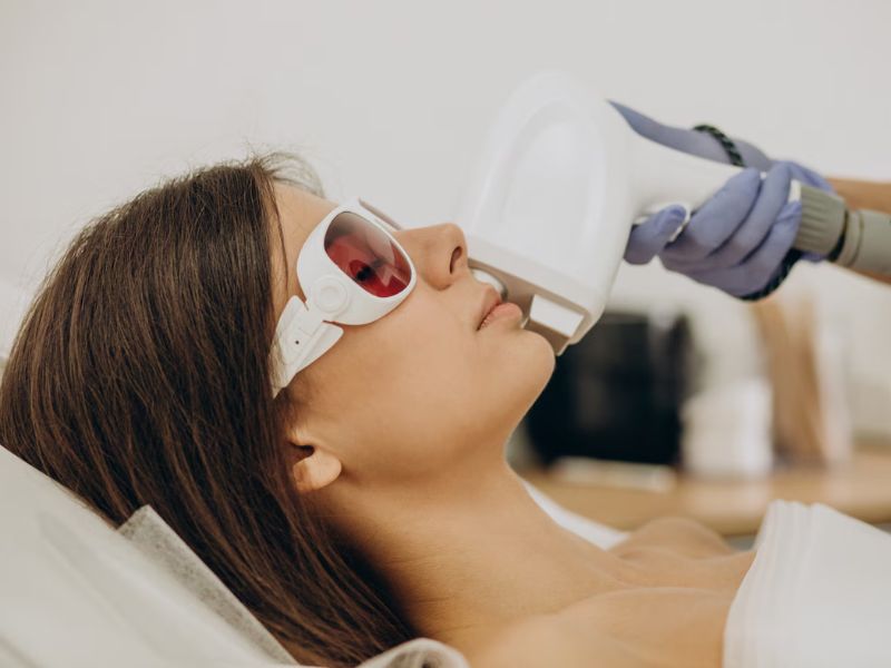 laser treatment